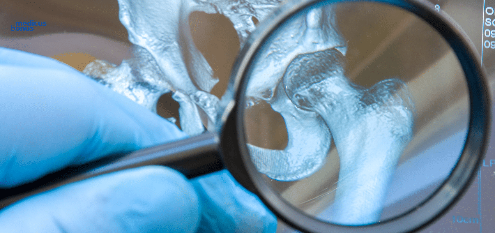 endoprotezoplastyka Poznań