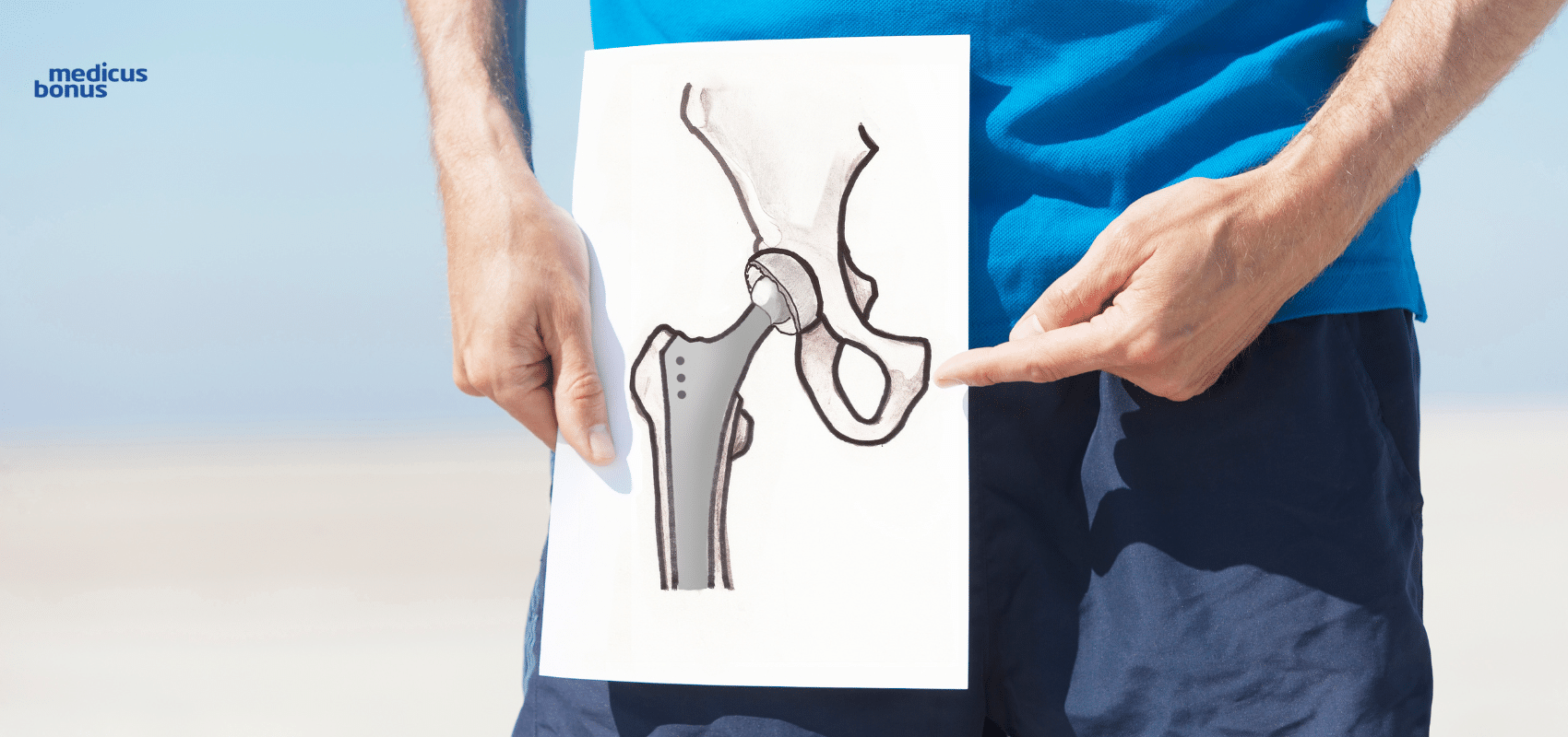 staw biodrowy Poznań