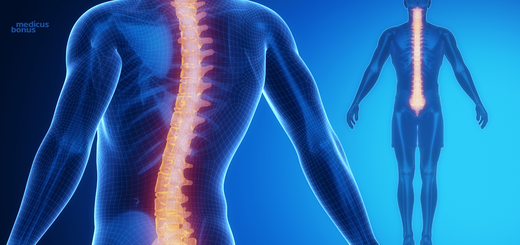 zabieg ostrzyknięcia kręgosłupa Murowana Goślina